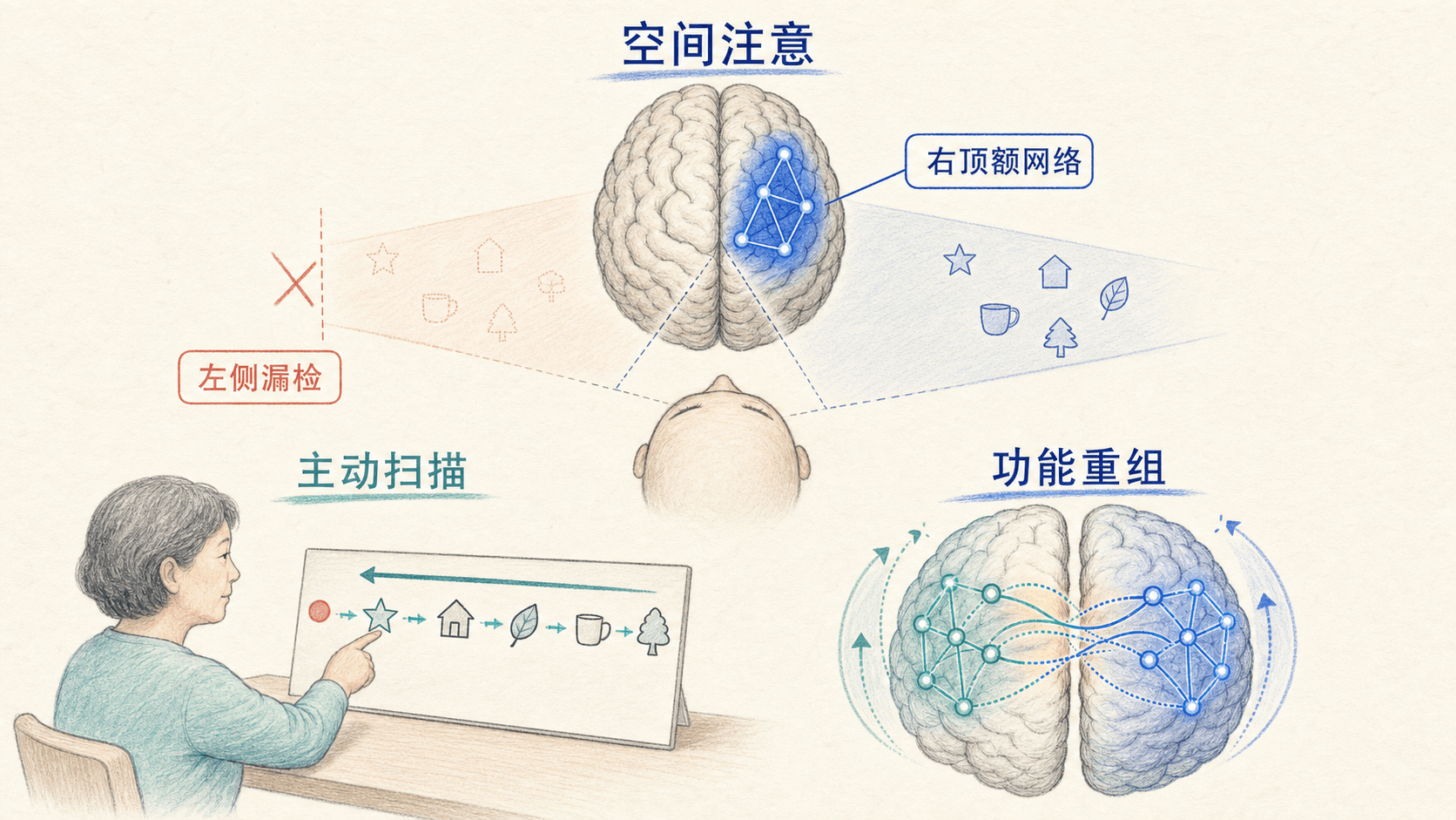 空间注意受损、主动扫描策略与功能重组关系的手绘信息图