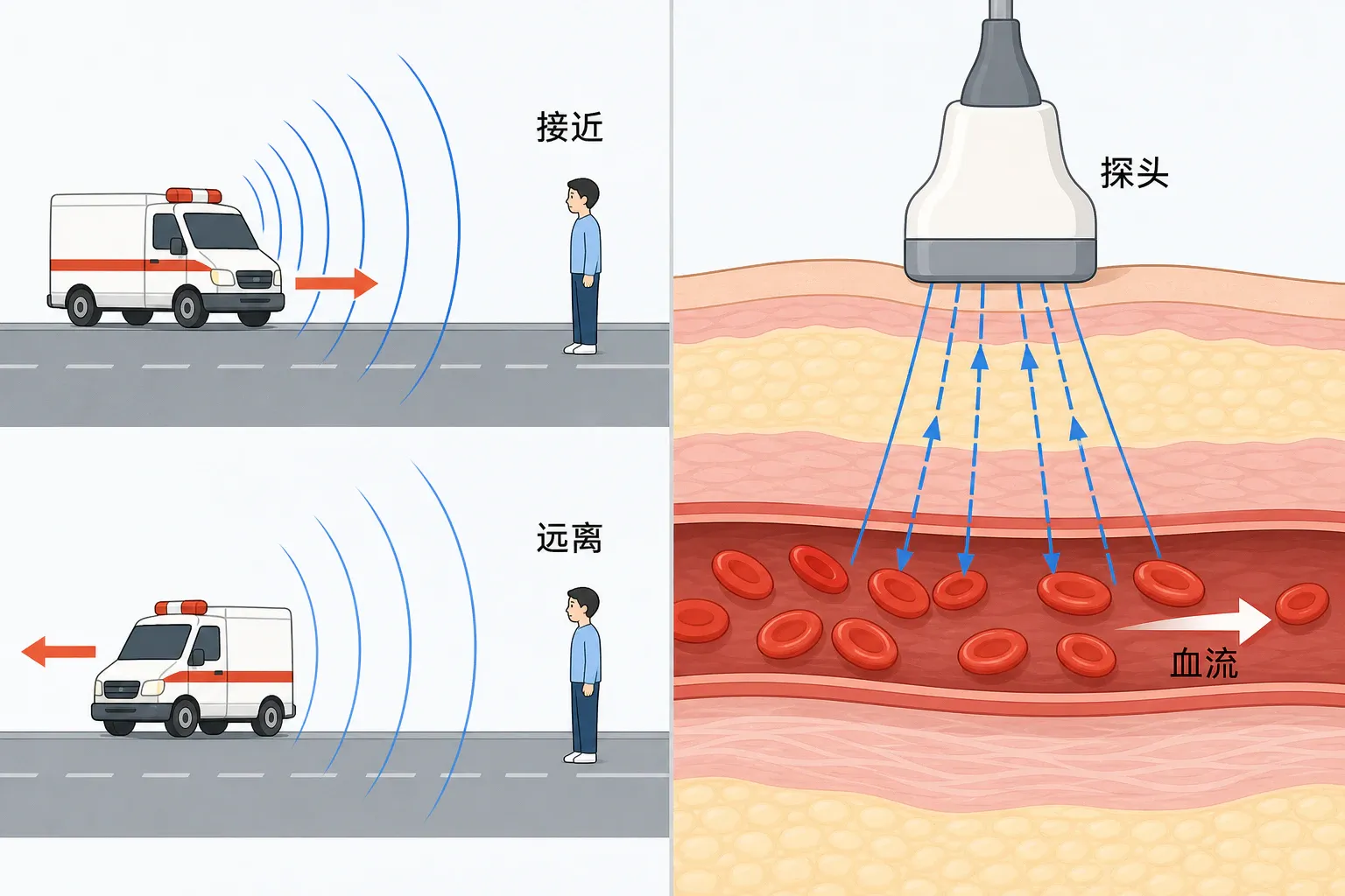 鸣笛声接近远离与超声检测血流的多普勒应用